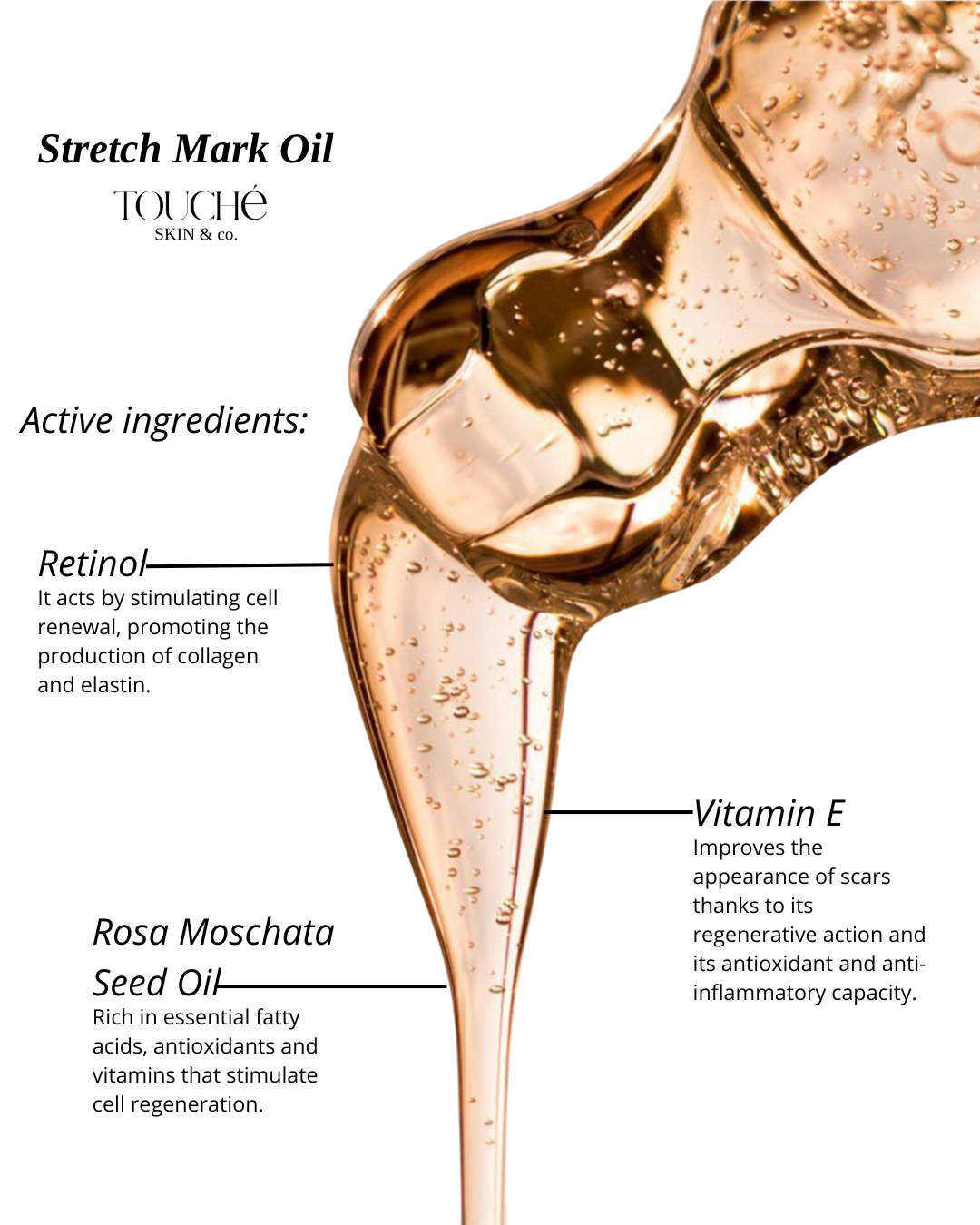 Stretch Marks Oil